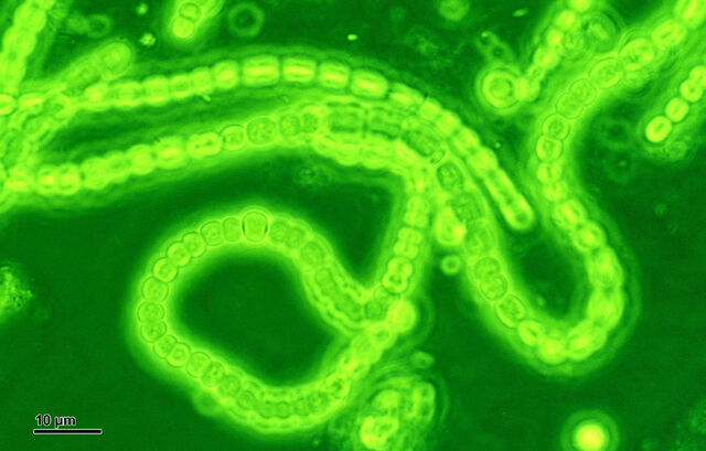 File:Cyanobacteria (248 07) Mixture; native preparation; green filter.jpg