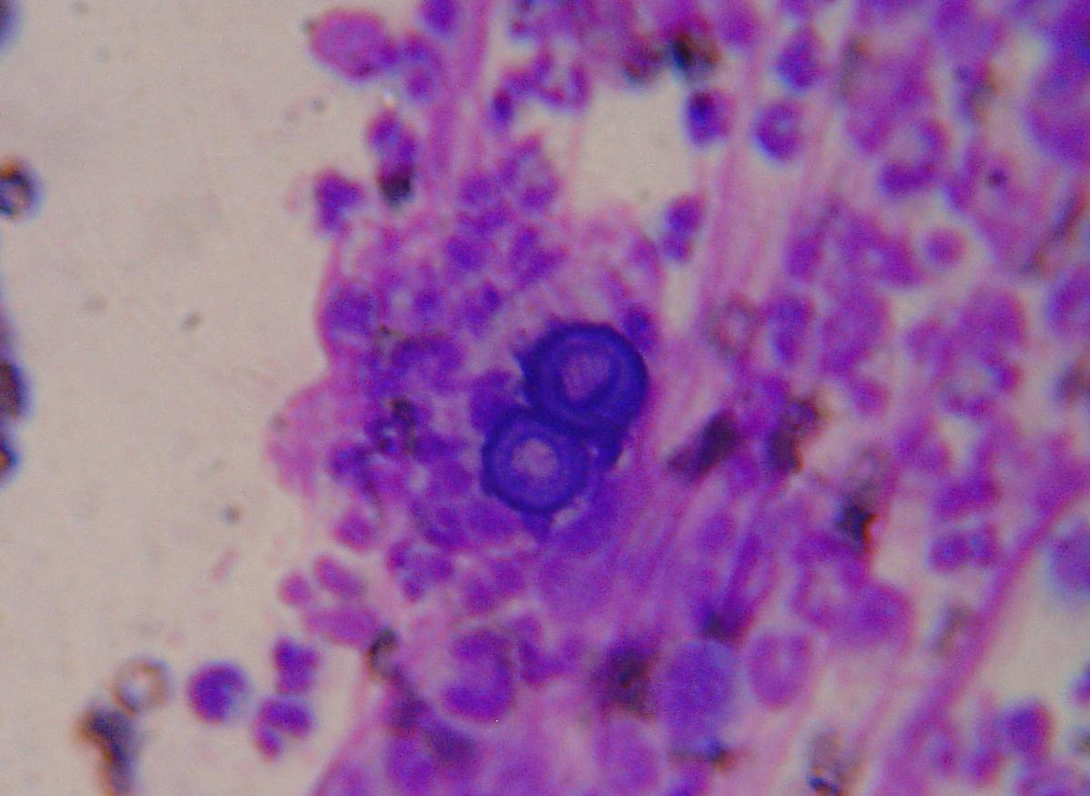 blastomycosis-house-wiki-fandom-powered-by-wikia