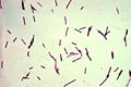 120px-Clostridium perfringens
