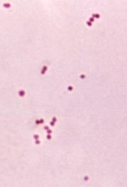 Neisseria meningitidis (cropped)