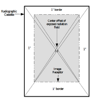 X-ray Field to Image Receptor Alignment