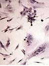 Herpes 2