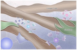 Complicacaovascular3