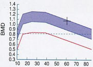 Osteoporose4