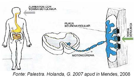 Botulsimo3