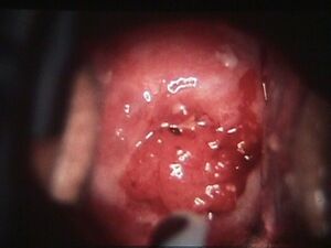 C C Utero3