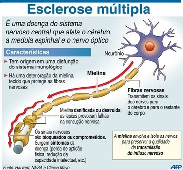 Esclerose2