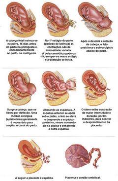 Parto2