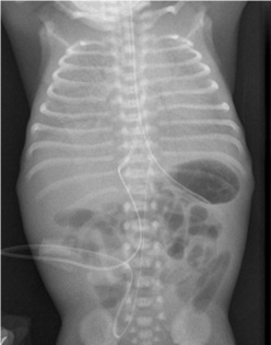 Resp.Neonato 1