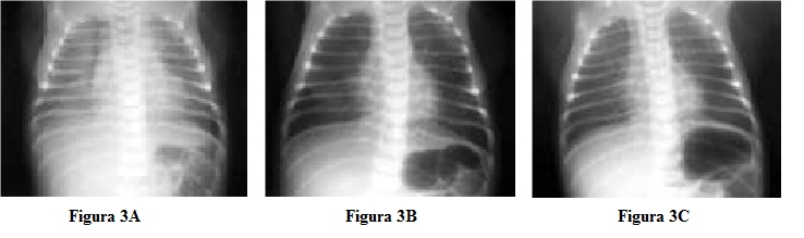 Resp.Neonato 3
