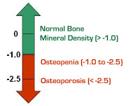 Osteoporose5
