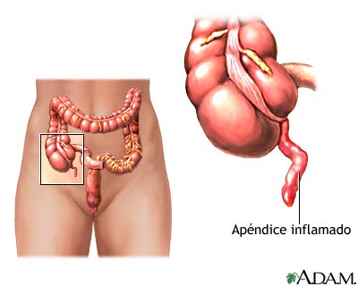 Apendice4