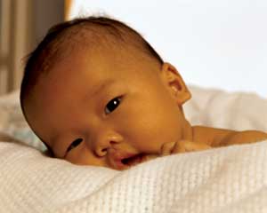Icterícia Neonatal | InfomedicaRascunho Wiki | FANDOM powered by Wikia