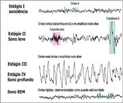 Figura 5 - estagios sono