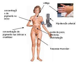 Fig 9
