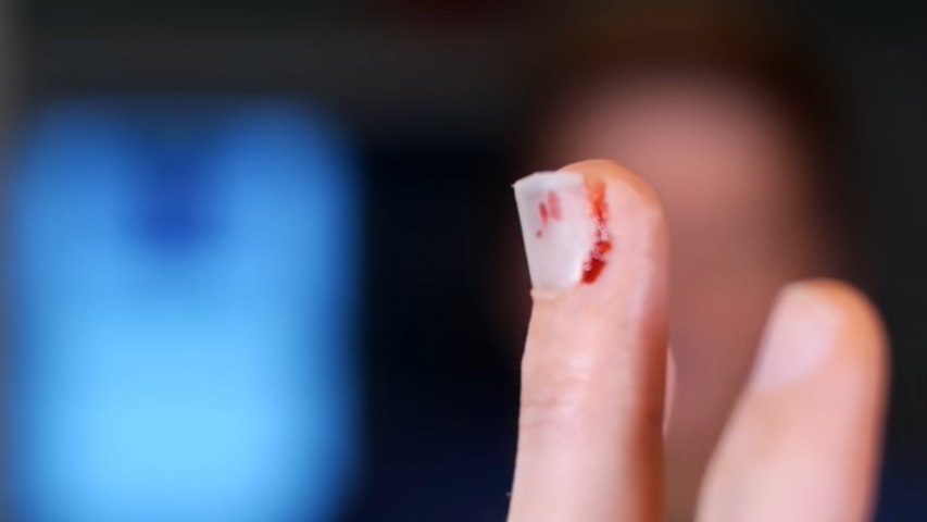 BROKEN FINGERNAIL! | JesseAndMike Wiki | Fandom