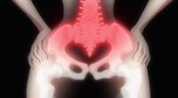Damagedhip