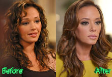 Leah-Remini-Before-and-After-Cosmetic-Surgery