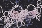 Endoparasiten