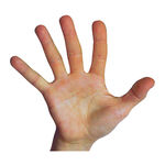 Spatulate hand