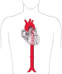 Aorta-diagram