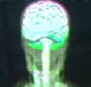Aenar brain