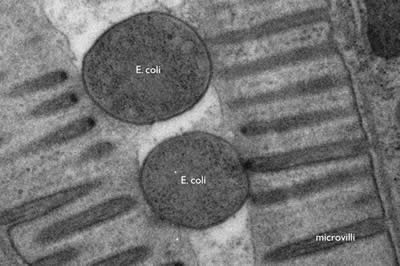 Transmission Electron Microscopy | Microbiology Wiki | FANDOM ...