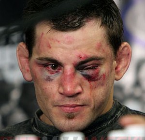 Fitch's face