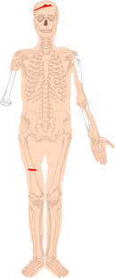 Borremose Man Scheme