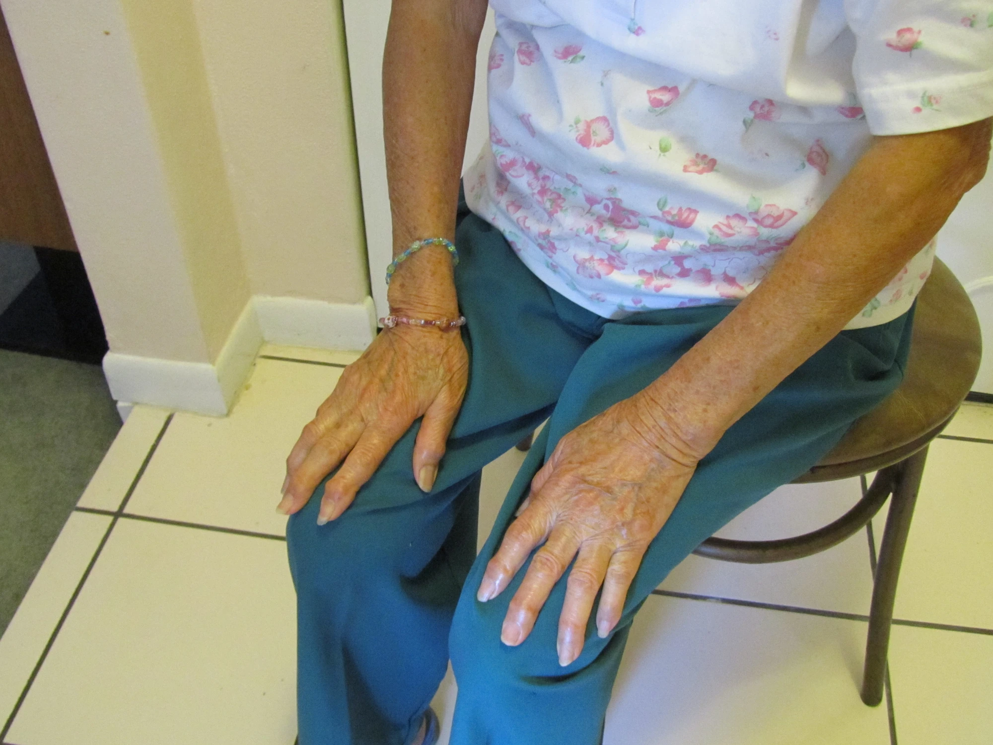 Body Percussion Music Therapy Activities Wiki FANDOM powered by Wikia