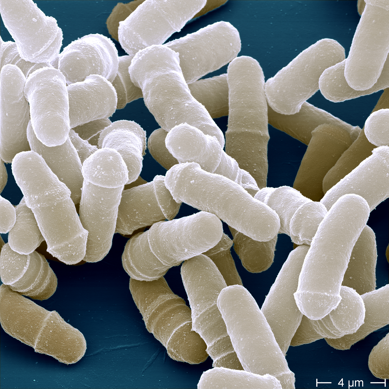 Image - Schizosaccharomyces.jpg | 식품영양 위키 | FANDOM powered by Wikia