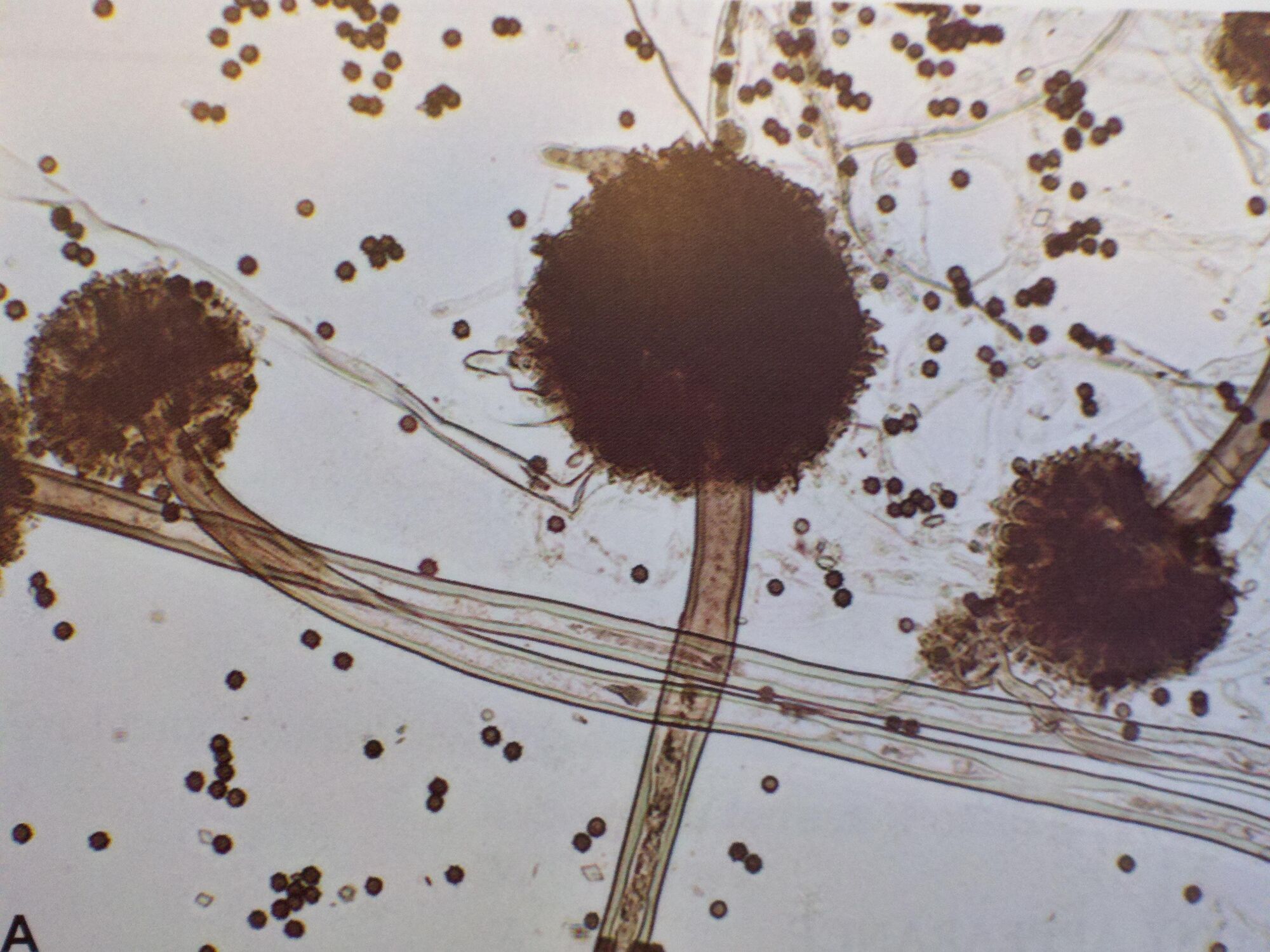 Aspergillus Niger 식품영양 위키 FANDOM powered by Wikia