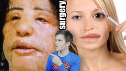 Plastic surgery