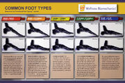 Common Foot Types Poster 2018