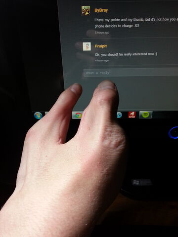 File:My hand.jpeg