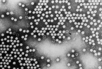 Polio