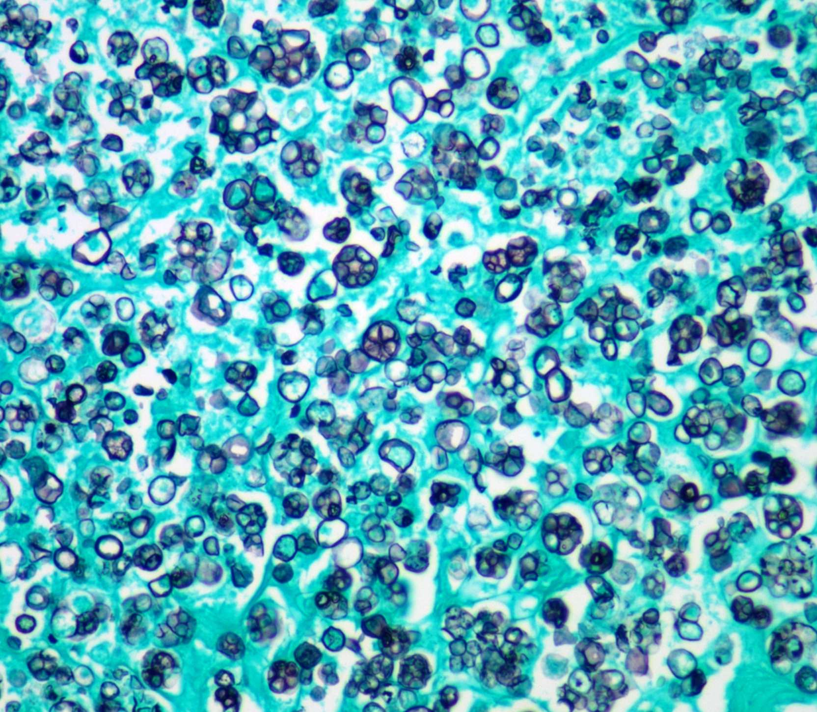 gms stain