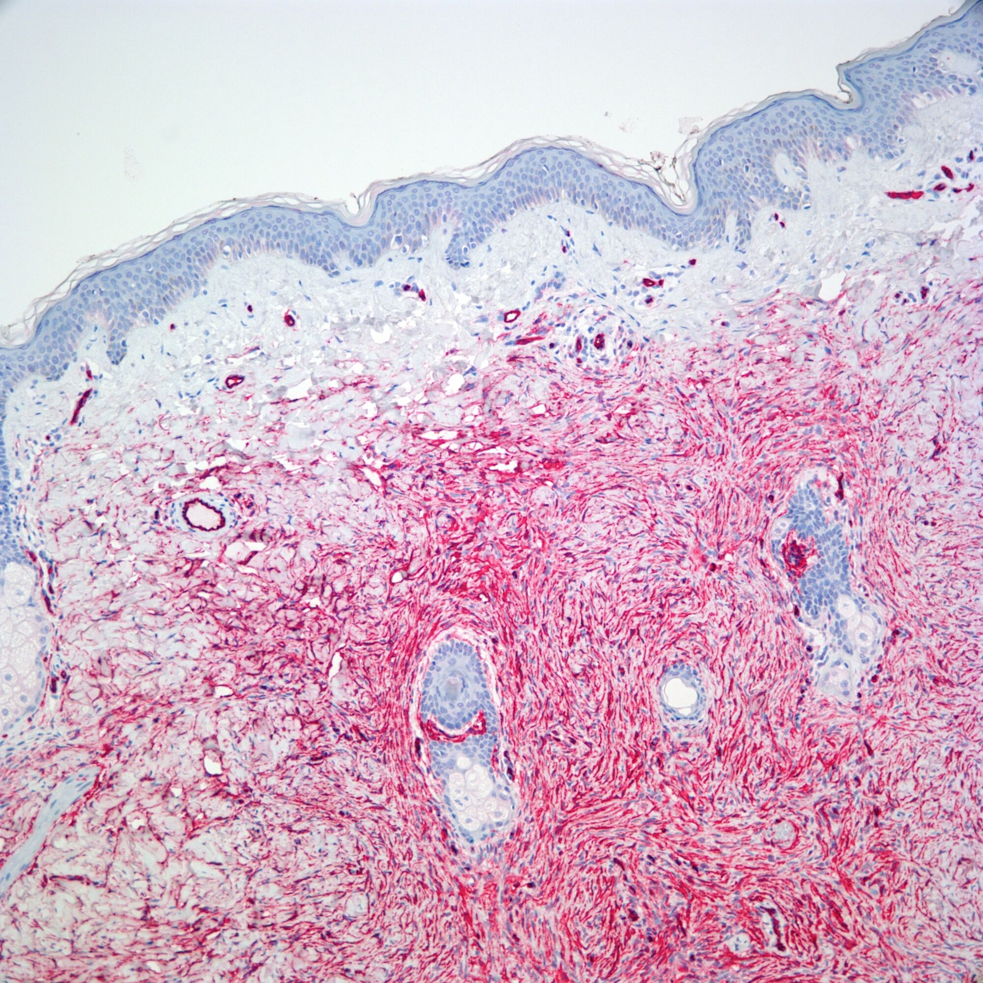 Dermatopathology Fellowship Directory | Pathology Resident Wiki | Fandom