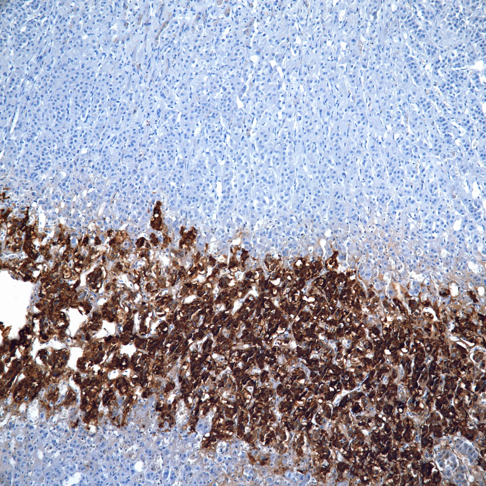 Image Chromogranin.adrenal medulla.jpg Pathology Resident Wiki