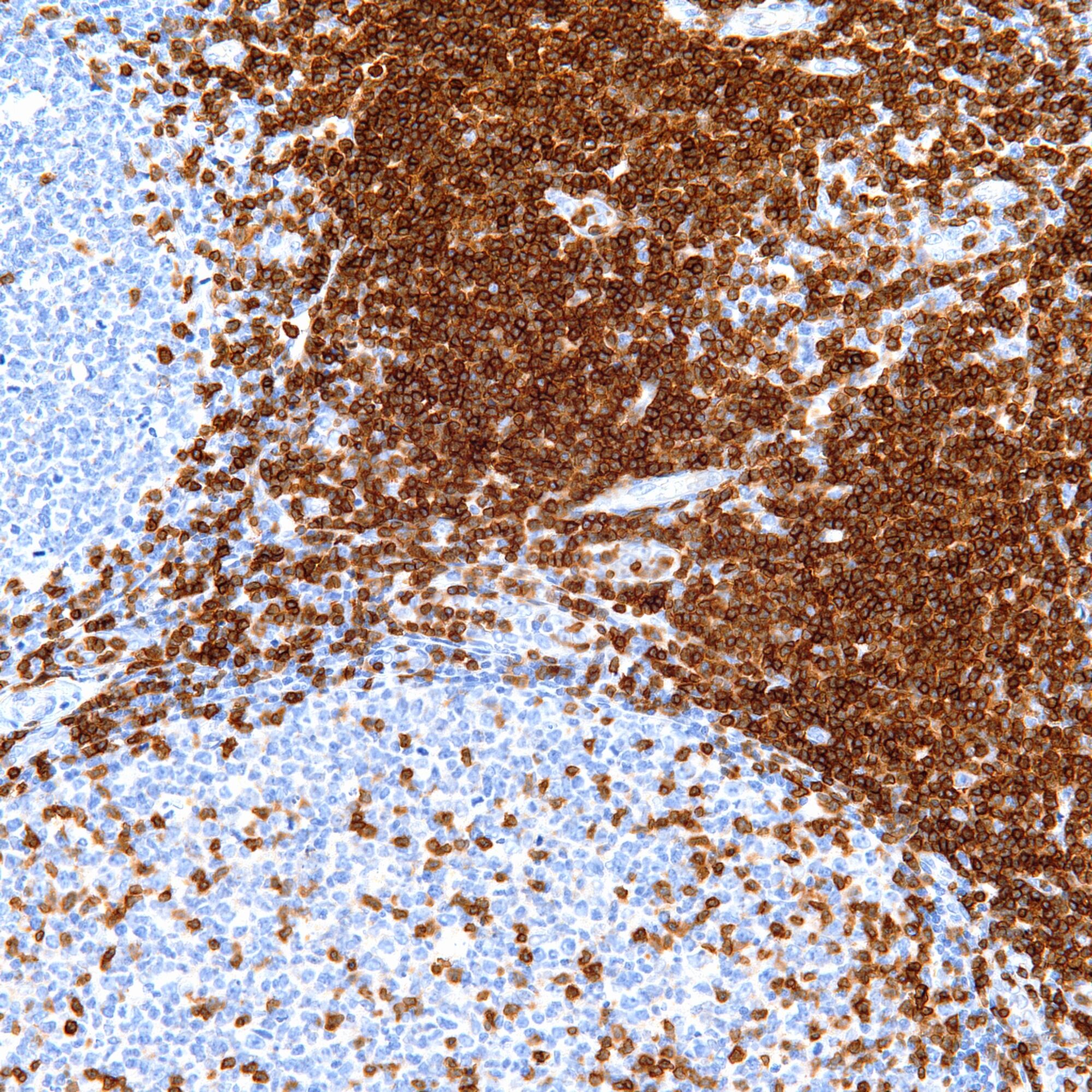 Category Immunohistochemistry Pathology Resident Wiki FANDOM Category Immunohistochemistry Pathology Resident Wiki FANDOM