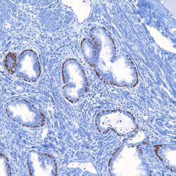 P63.prostate