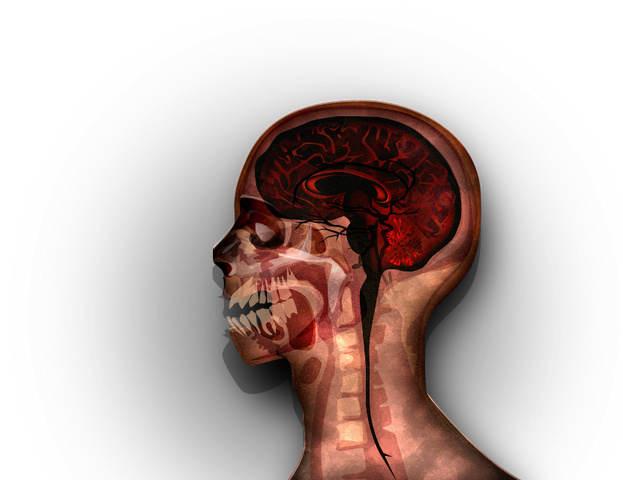 File:MRI stage05@2x.png