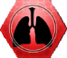 Stn Pulmonary Oedema