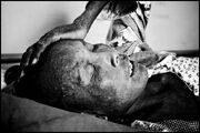 Cambodia AIDS Victim