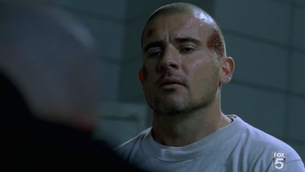 Injuries Prison Break Wiki Fandom Powered By Wikia