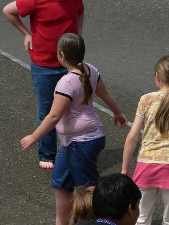 Obesity Psychology Wiki Fandom
