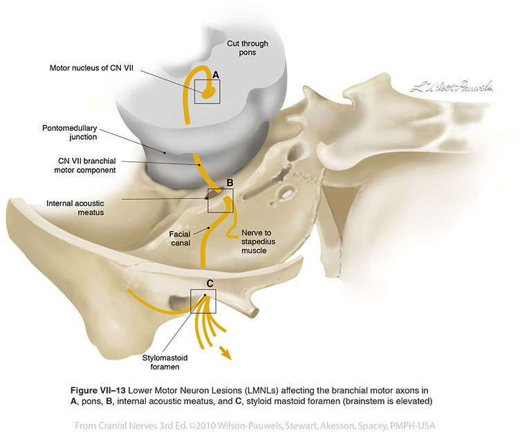 Intracranial cavity (extra axial): Posterior cranial fossa:Internal