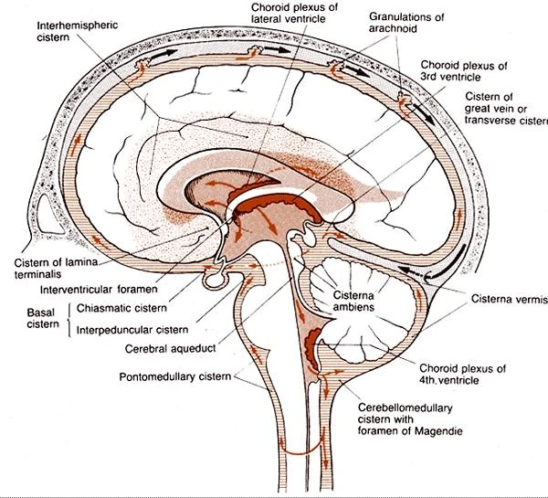 4. Basal CSF cisterns | RANZCRPart1 Wiki | Fandom