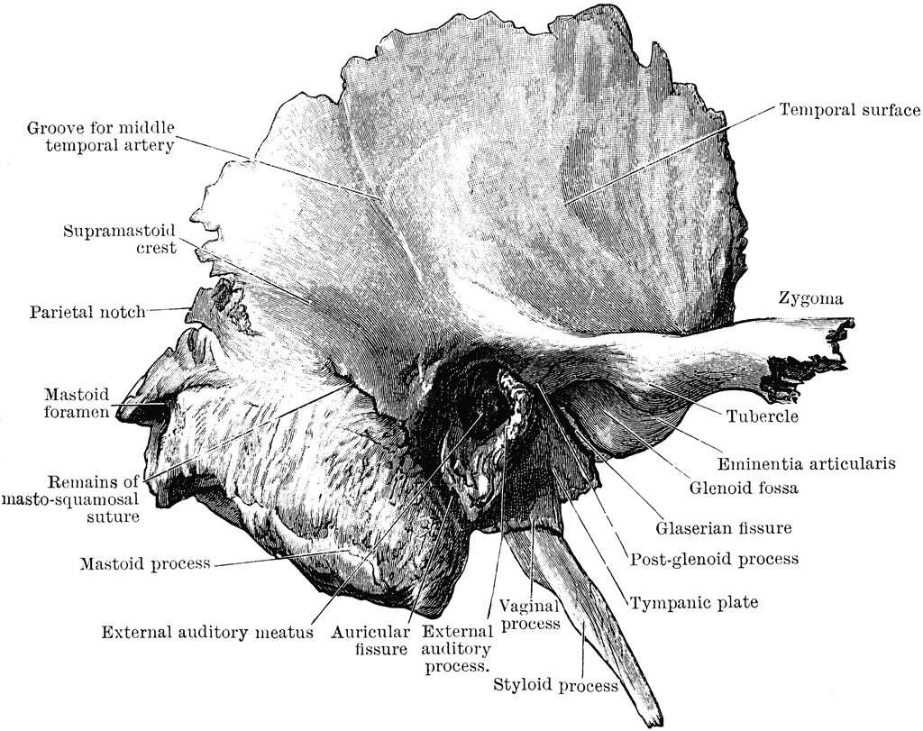 6. Temporal bone | RANZCRPart1 Wiki | FANDOM powered by Wikia