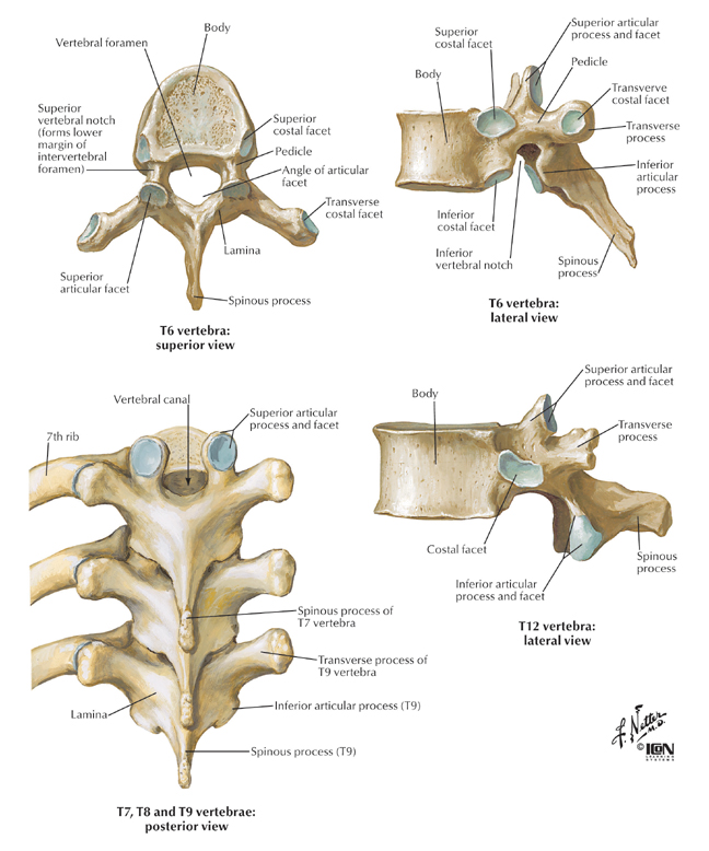 Spine & Back:Bones:Thoracic vertebrae | RANZCRPart1 Wiki ...